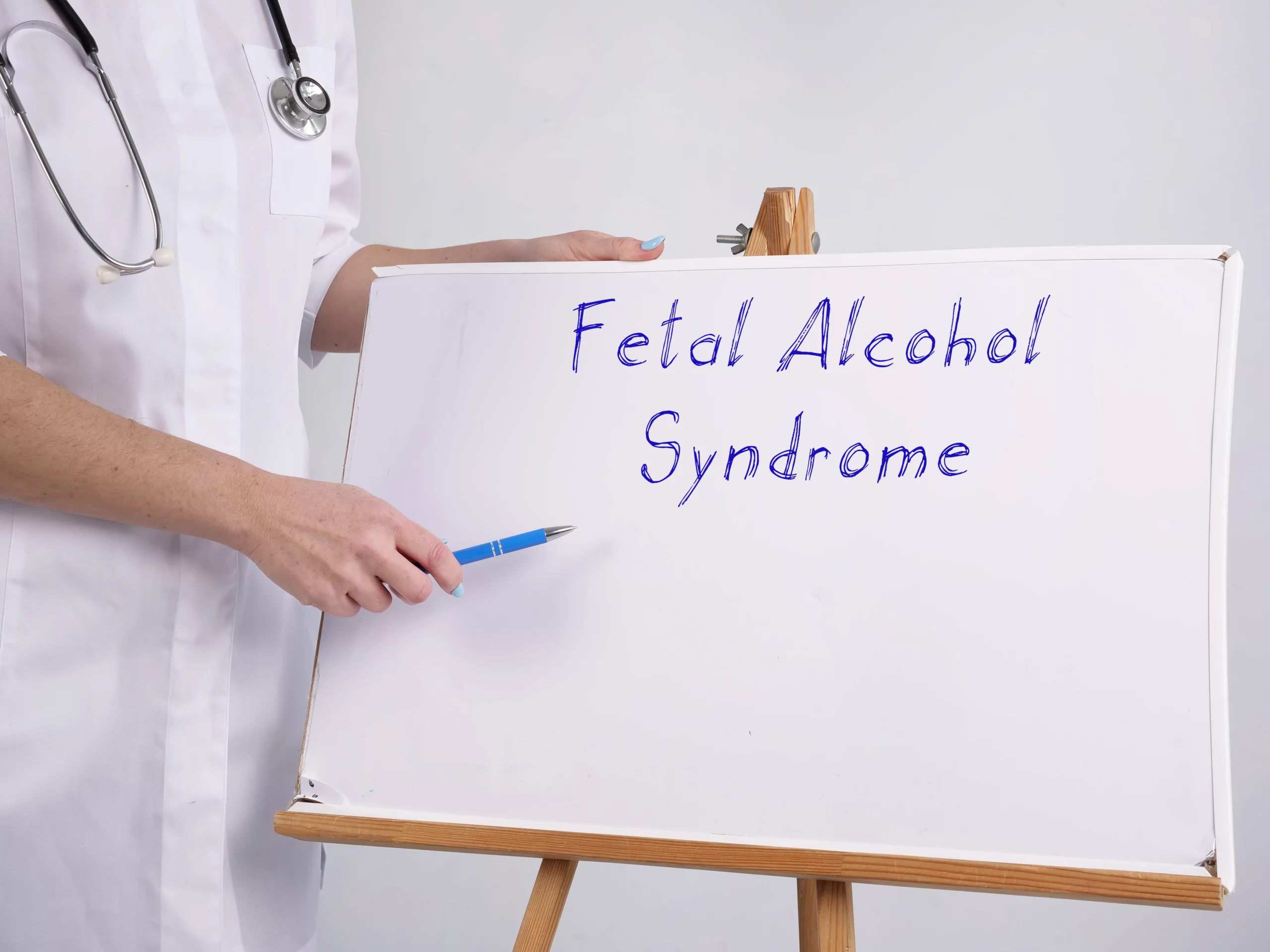 famous people fetal alcohol syndrome